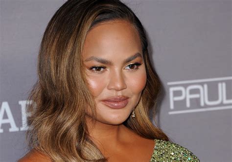 buccal fat removal celebrities|Chrissy Teigen Had Bucca Fat Removal — Heres What It Is